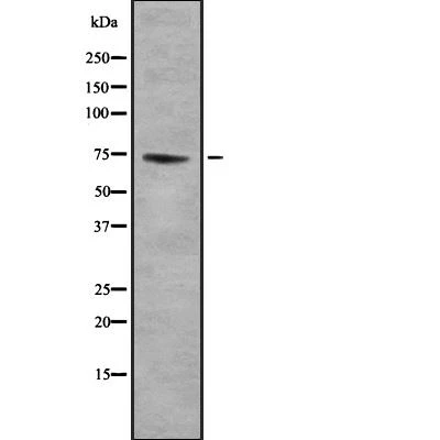 Rabbit anti-GTPBP4 Polyclonal Antibody#abs137352 Rabbit anti-GTPBP4 Polyclonal Antibody#abs137352