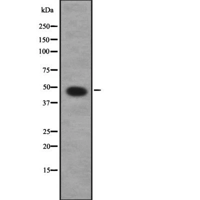 Rabbit anti-CASQ2 Polyclonal Antibody#abs137485