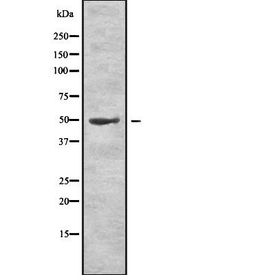 Rabbit anti-LCAT Polyclonal Antibody#abs137644