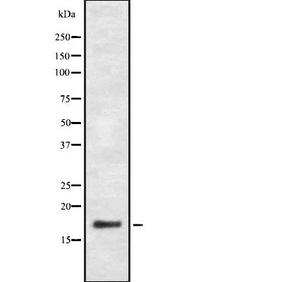 Rabbit anti-PGE synthase Polyclonal Antibody#abs138112 Rabbit anti-PGE synthase Polyclonal Antibody#abs138112