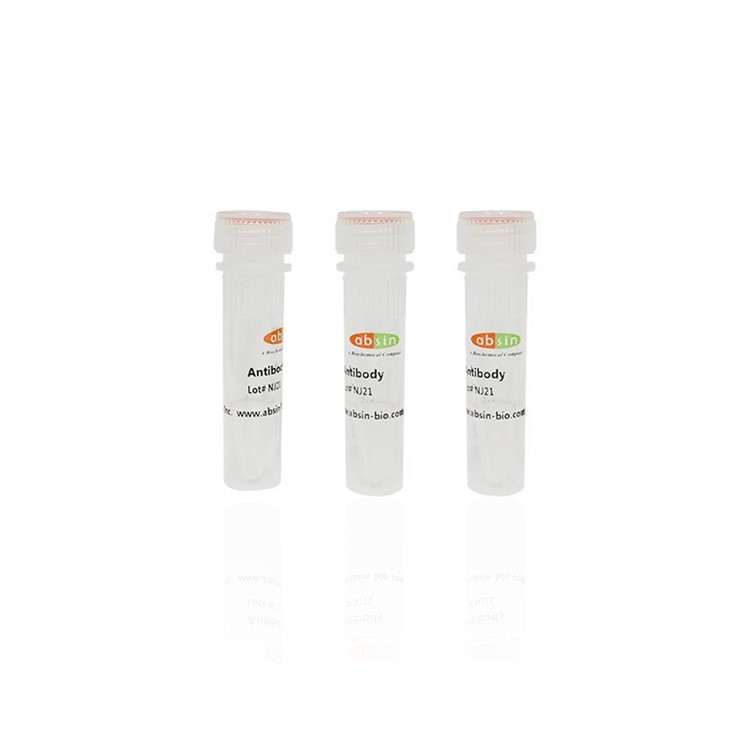 Rabbit Anti-NEK8 Polyclonal Antibody#abs135686