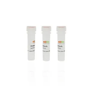 Rabbit Anti-ST6GAL1 Polyclonal Antibody#abs141029