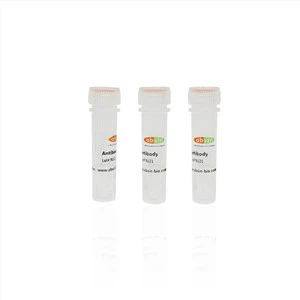 Rabbit Anti-T-cadherin Polyclonal Antibody#abs131297